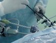 mini-laparoskopi-mikro-laparoskopi