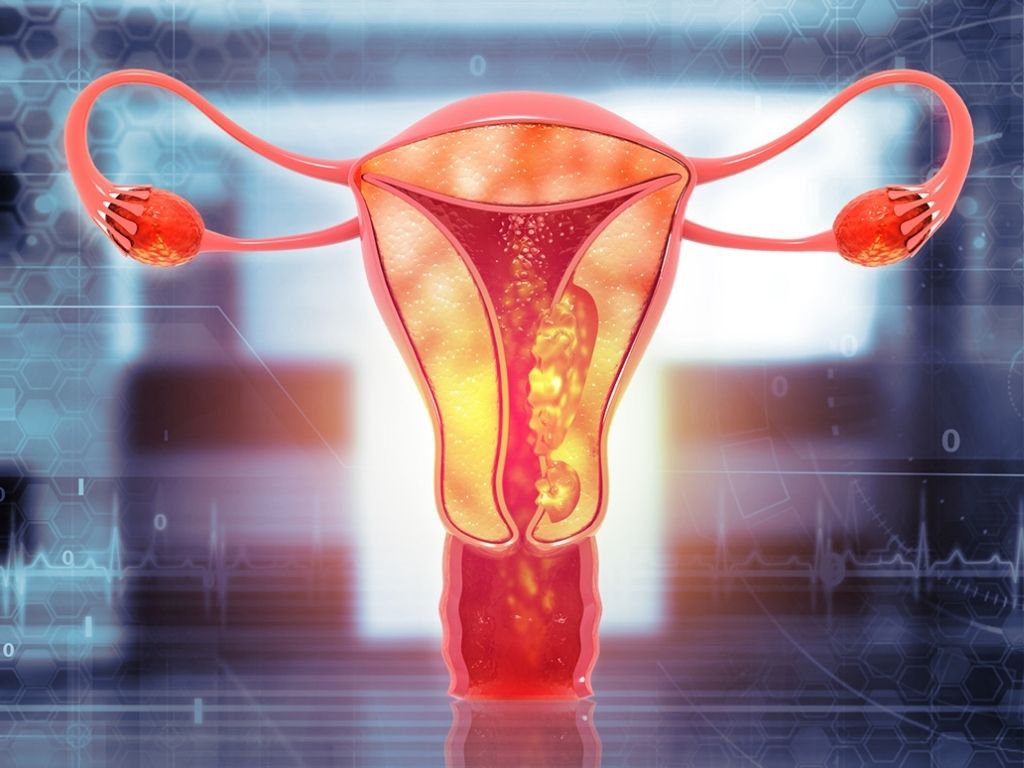 endometrium kanseri